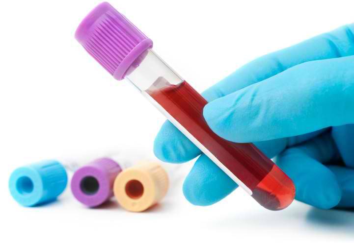 Herpes Blood Testing